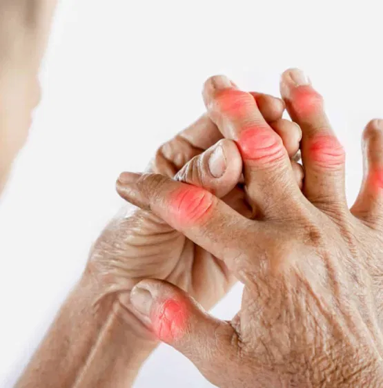 A Promising Approach for Arthritis Treatment