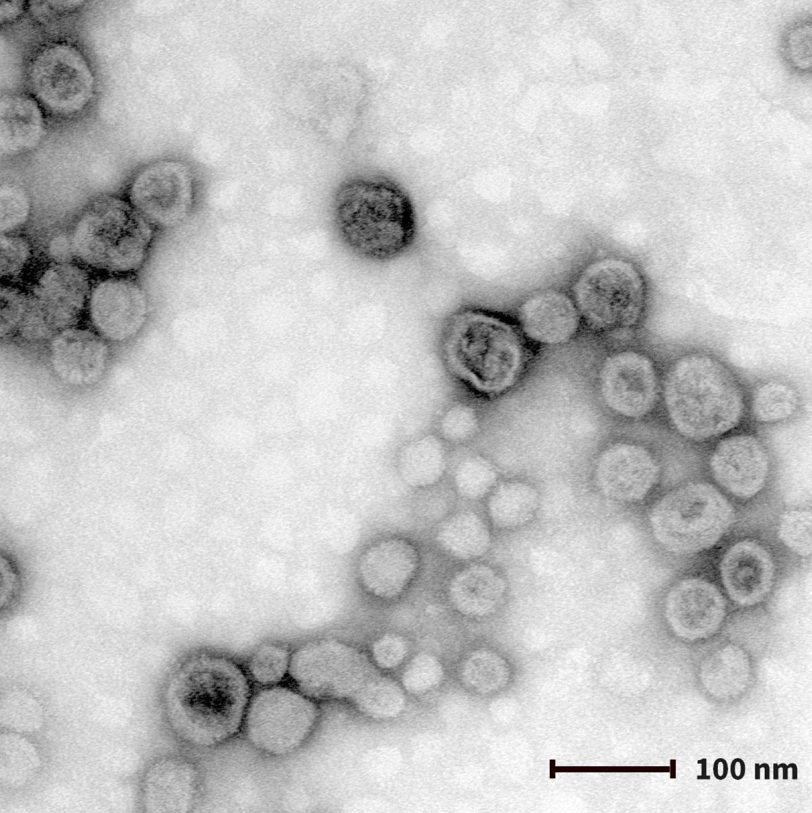 Exosomas