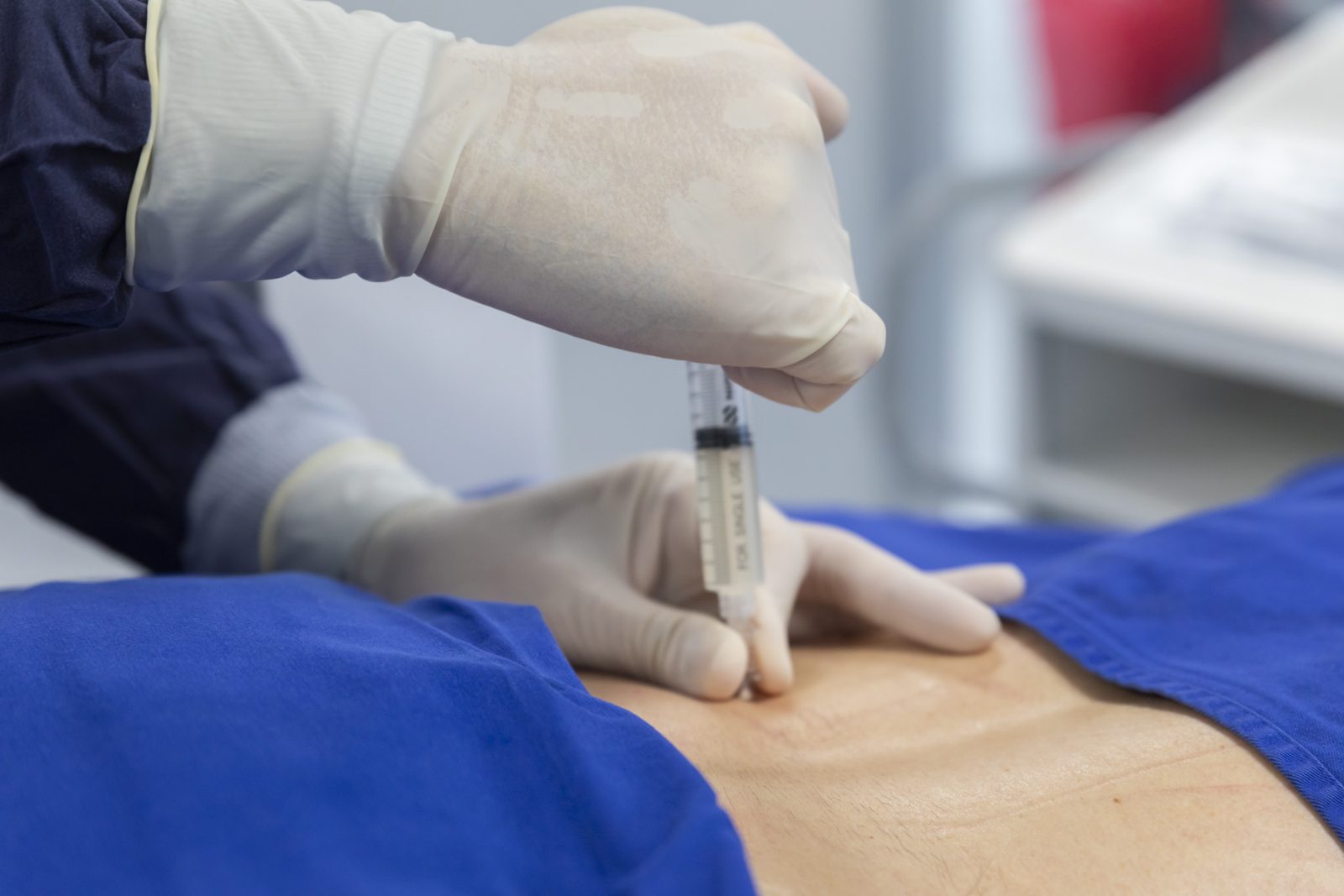 A syringe prepared for an application