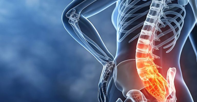 Lumbar pain (Back pain)