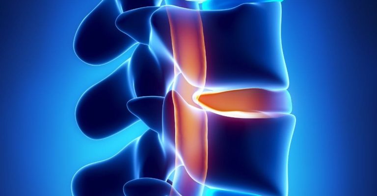 Spinal Cord Injuries